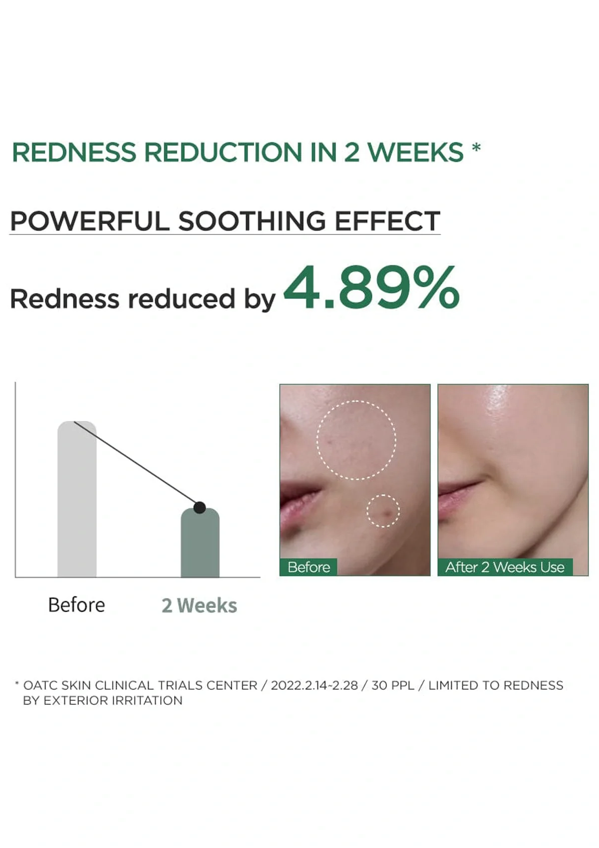 [ANUA] Heartleaf 80% Moisture Soothing Ampoule 30ml - Image 5
