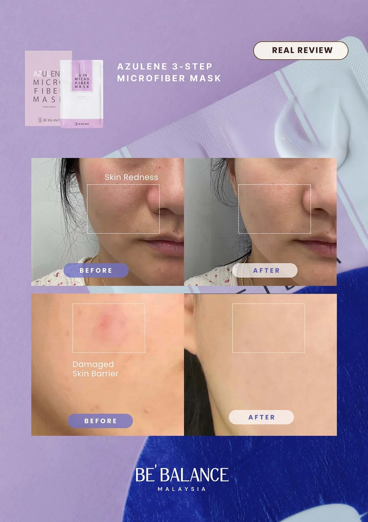 [BE'BALANCE] Azulene Microfiber Mask (1 Box = 30g x 10 Masks) - Image 9