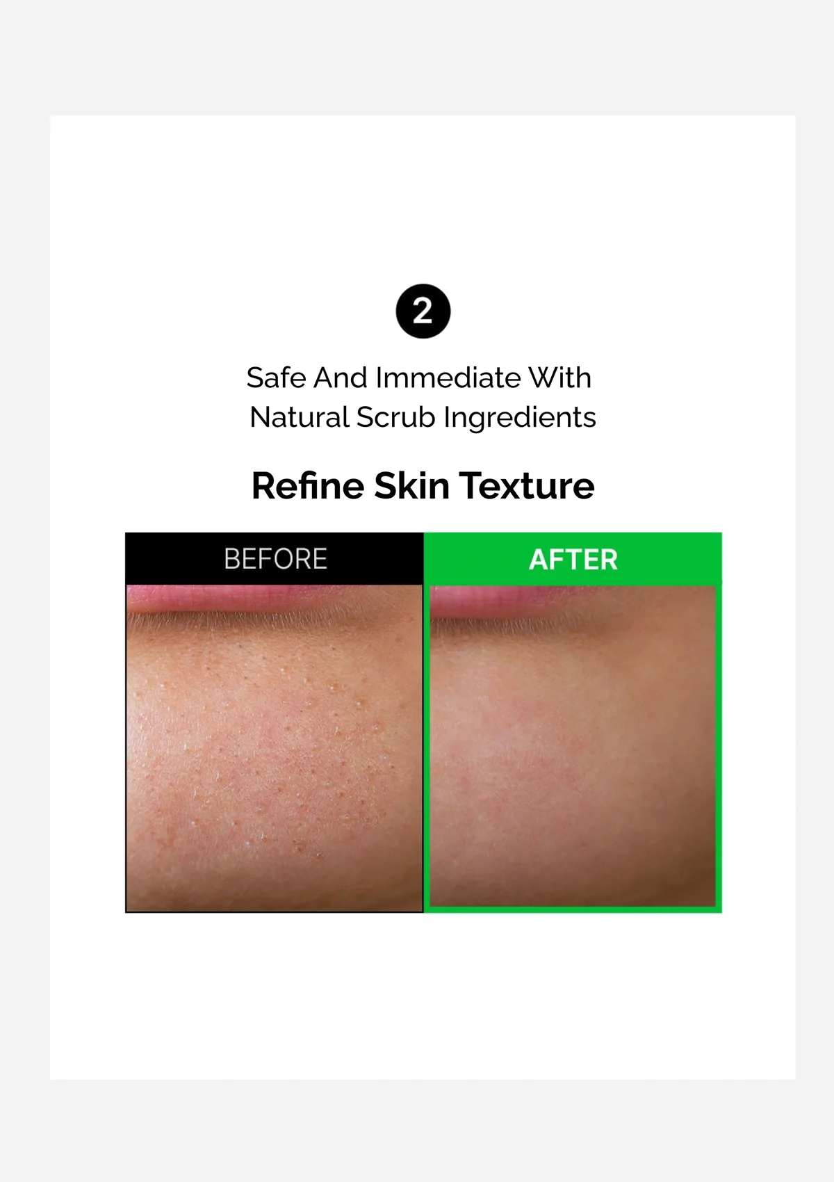 [FLANER] Green Caviar Ice Sherbet Peeling Mask 100g - Image 6