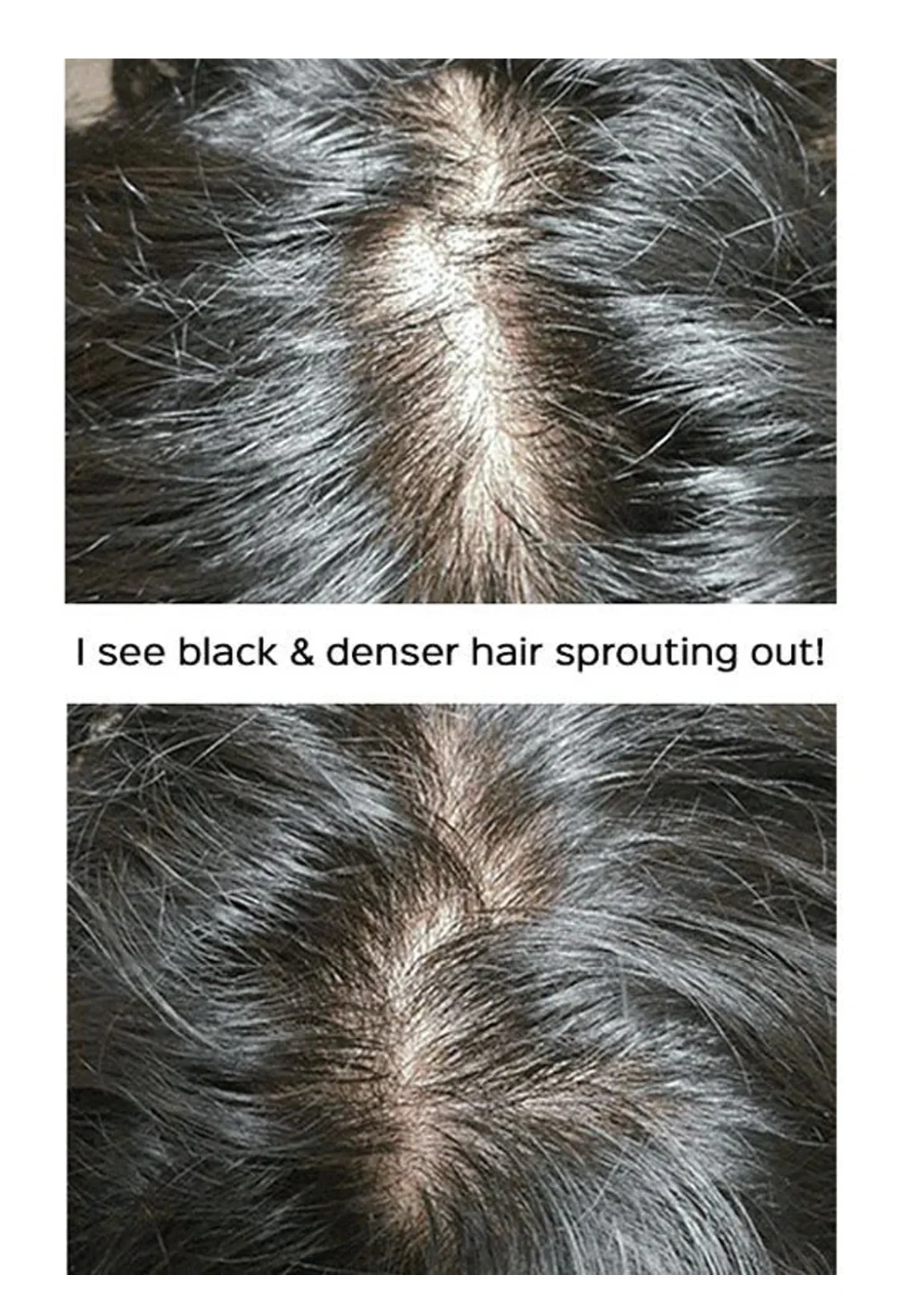 [MBA] Derma Black Turn & Protein Hair Shampoo 500ml - Image 4