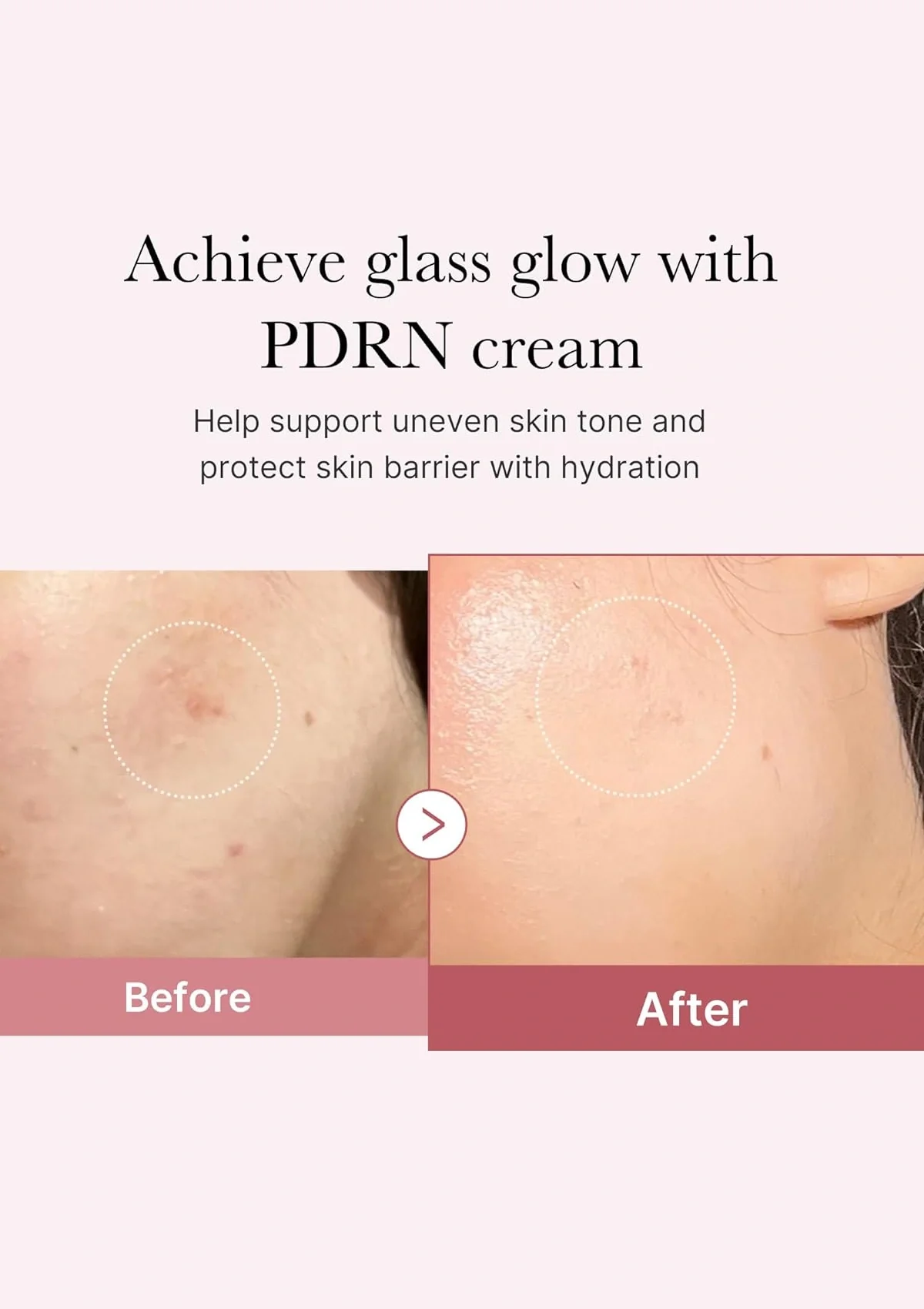 [MEDICUBE] PDRN Pink Hyaluronic Moisturizing Cream 50ml - Image 6