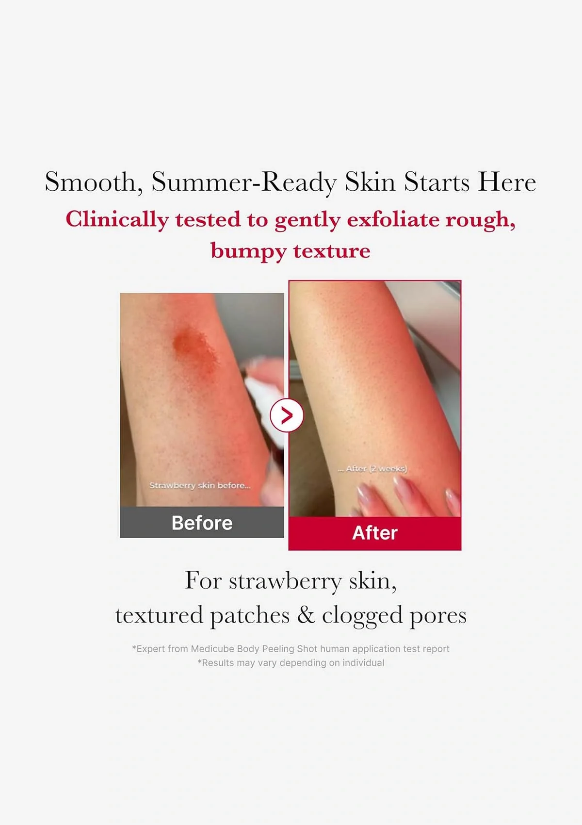 [MEDICUBE] Red Acne Body Peeling Shot Cleanser 110g - Image 7