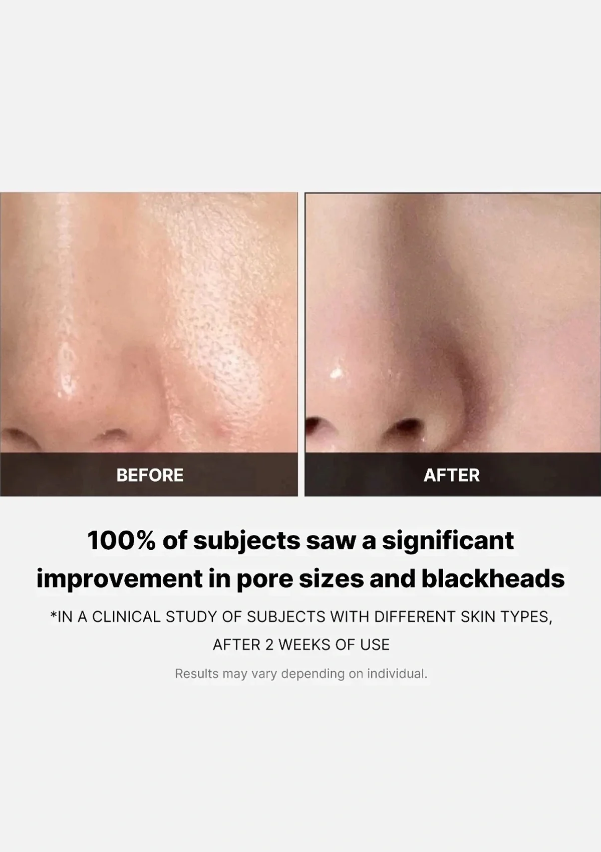 [MEDICUBE] Zero Pore Pad (1 Box = 70 Pads) - Image 8