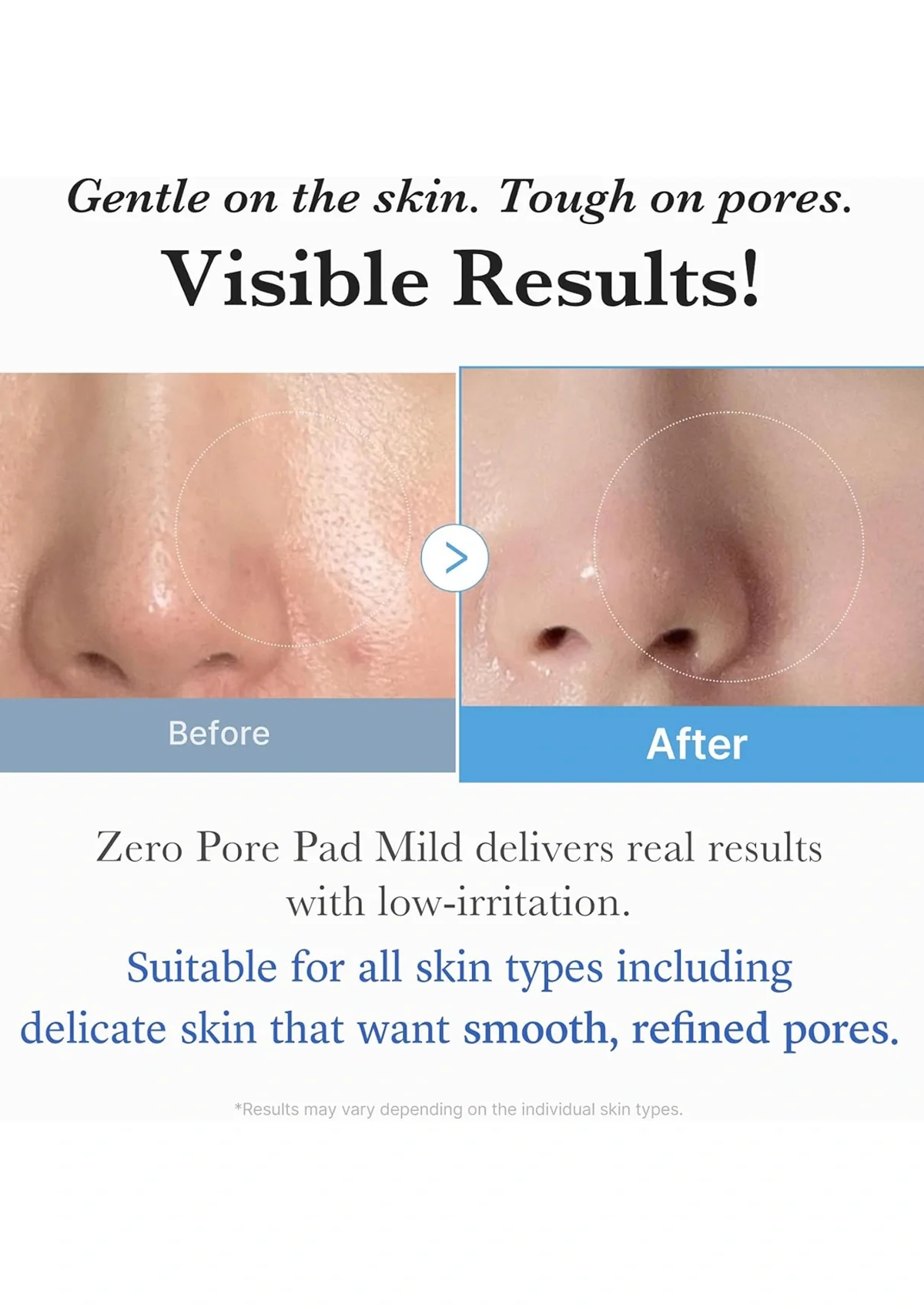[MEDICUBE] Zero Pore Pad Mild (1 Box = 70 Pads) - Image 7