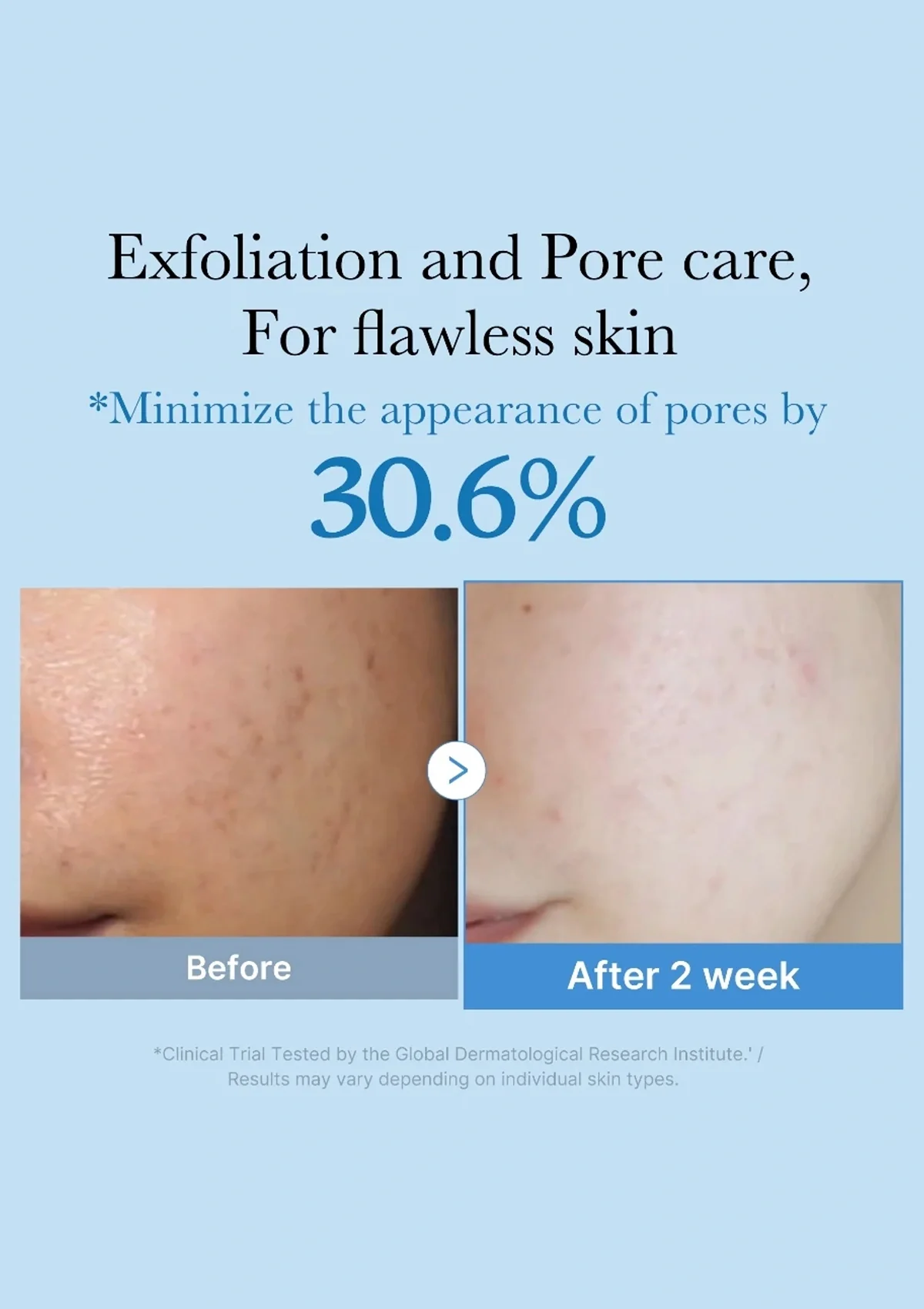 [MEDICUBE] Zero Pore Toner 250ml - Image 4