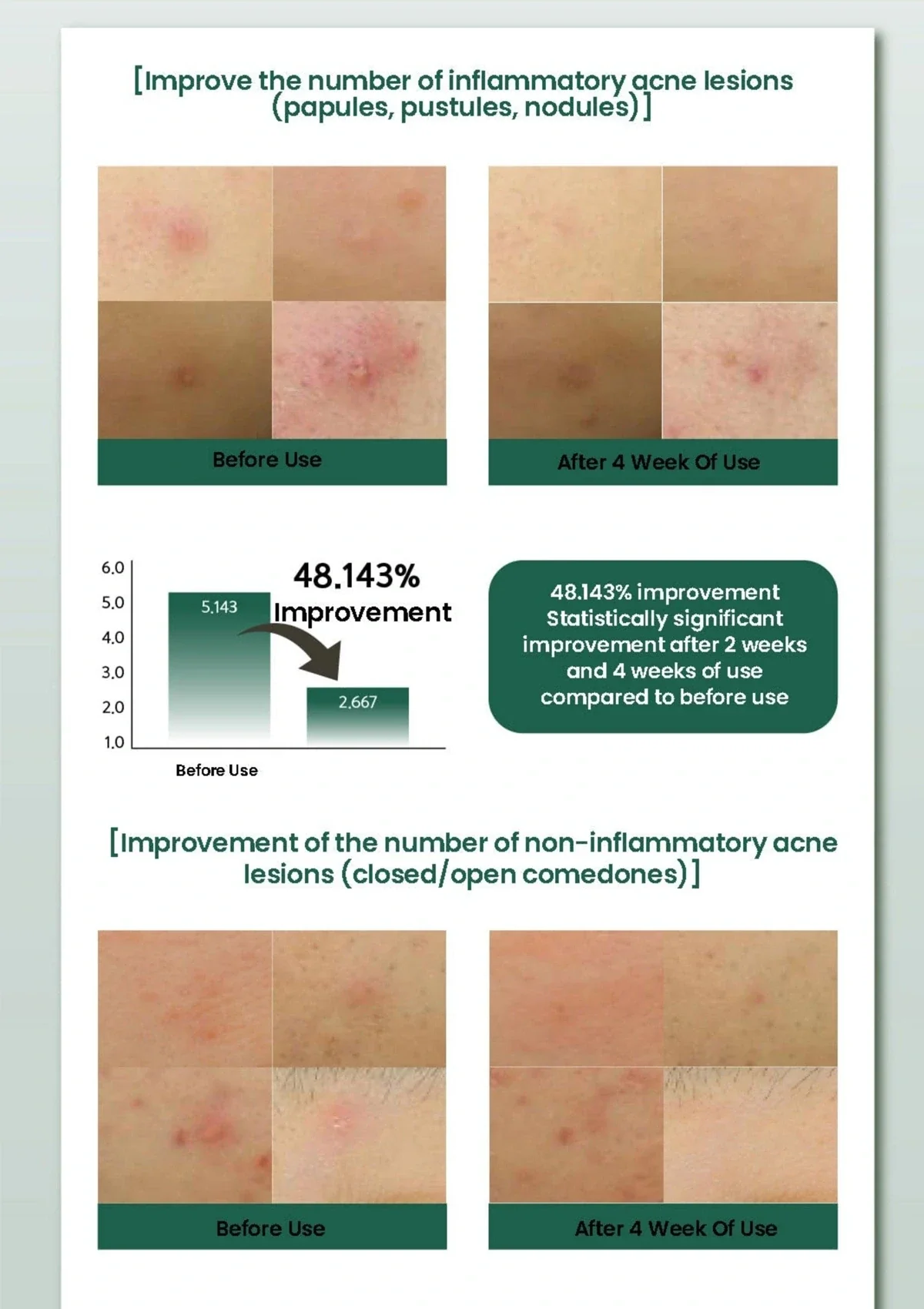 [MOLVANY] Artichoke Soothing Acne Pore Toner Pad 160ml (70 Pads) - Image 8