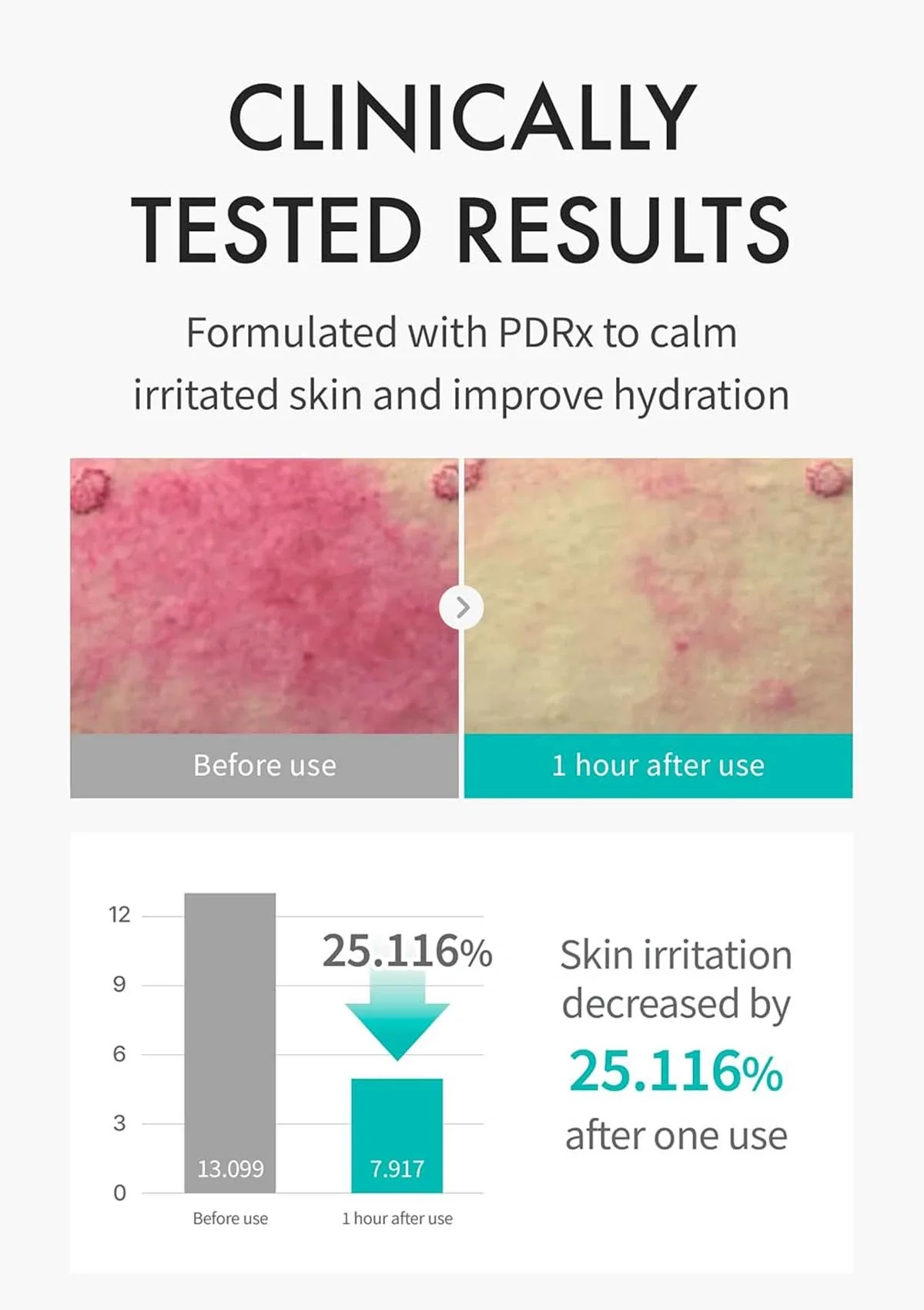 [REJURAN] Derma Healer Moisture Treatment Mask (1 Box = 23ml x 5 Masks) - Image 4