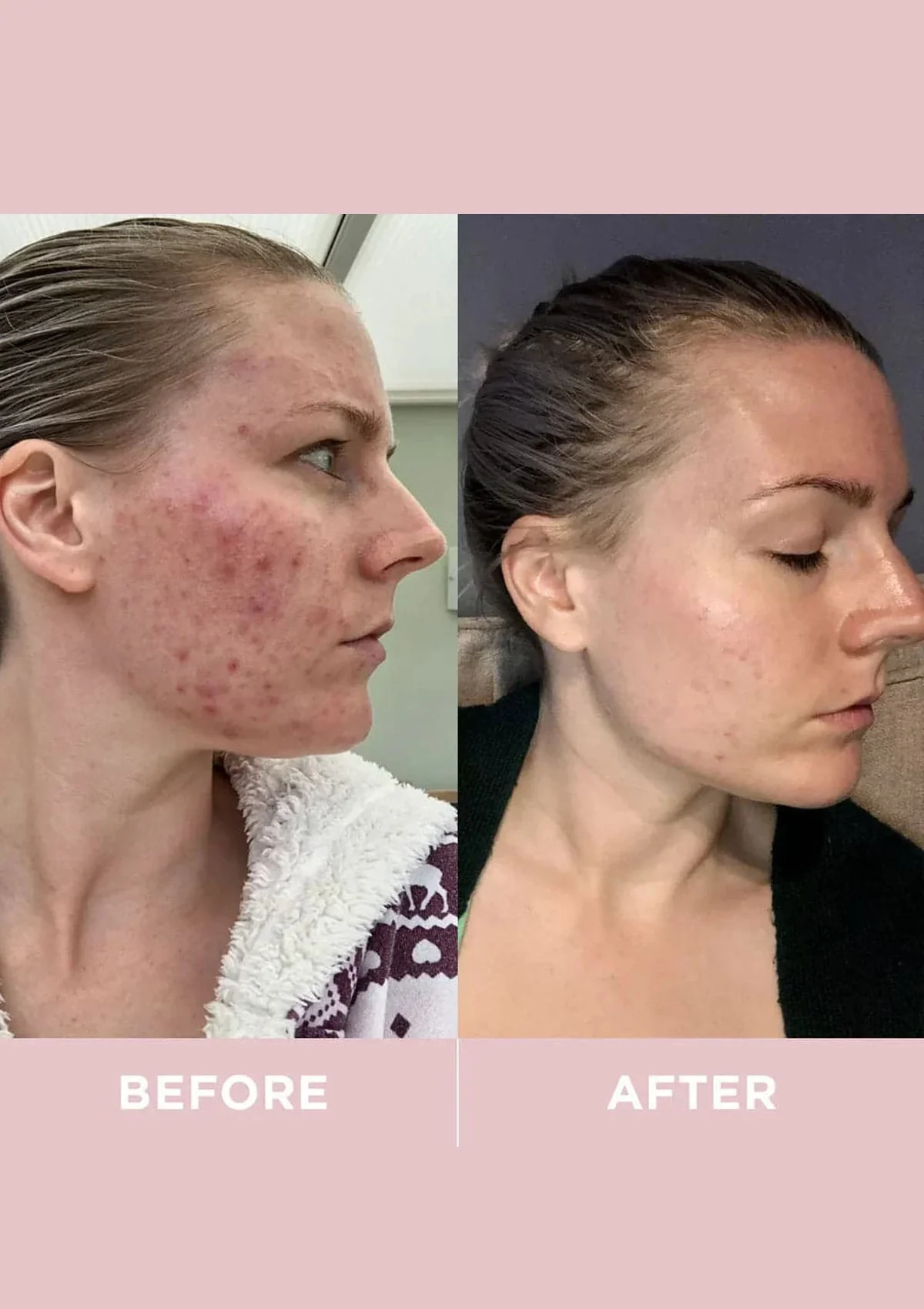 Revive Collagen Original - Hydrolysed Marine Collagen Drink - Image 6