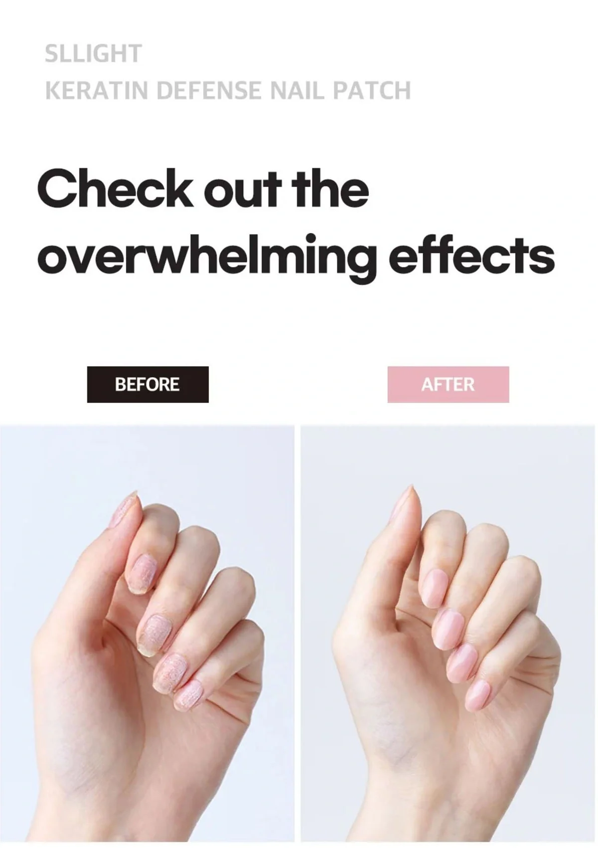 [SL LIGHT] Keratin Defense Nail Patch - Image 5