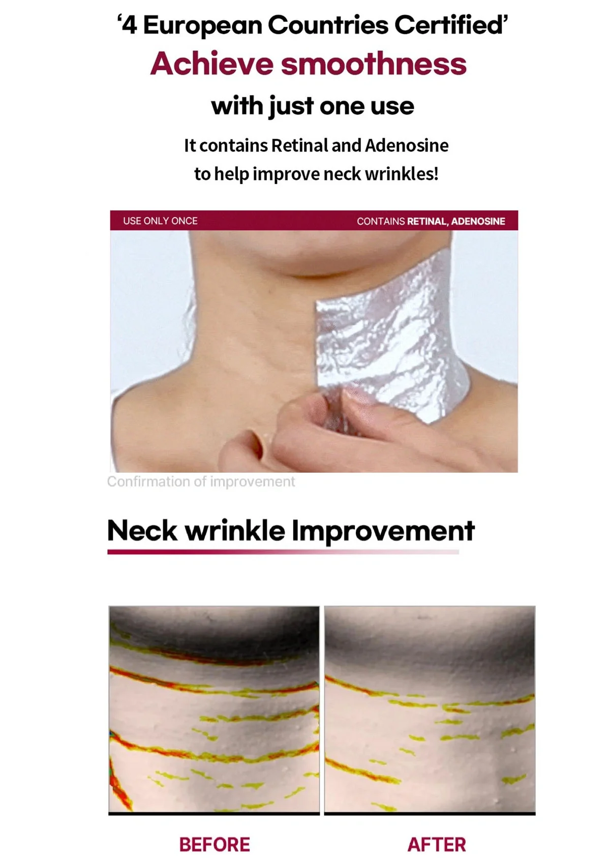 [SL LIGHT] Retinal Age-Reset Neck Patch (1 Box = 7g x 5 Patches) - Image 6