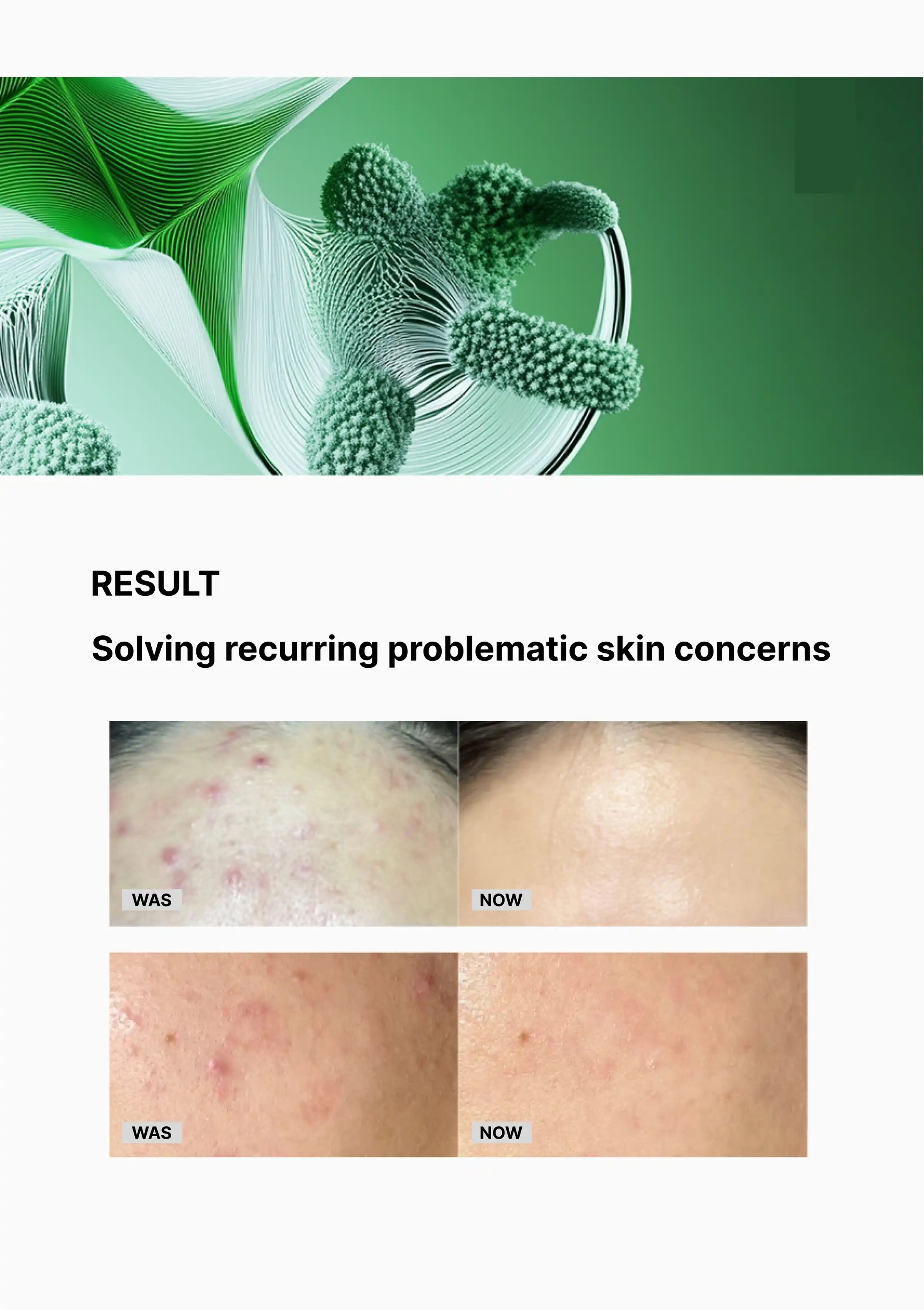 [VEMONTES] Axcne Booster Cream 50ml | Cream Mask 150ml - Image 10